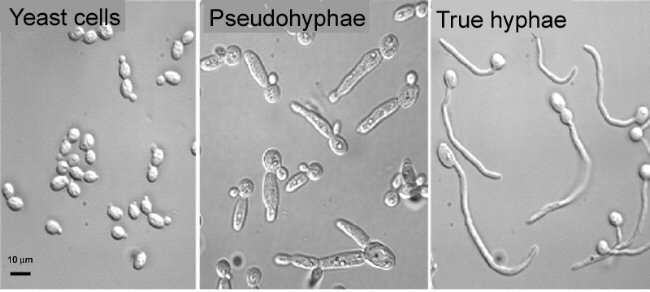 Dr. Catherine Bachewich: Role of hypA in Candida albicans